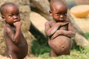 Lire la suite à propos de l’article Tanganyika: La vente et la consommation des aliments destinés aux enfants malnutris frappées d’interdiction