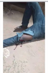 Lire la suite à propos de l’article Kasaï-Central : Un jeune homme blessé par balle dans une dispute avec un policier