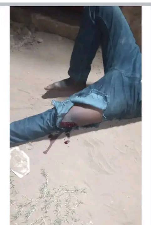 You are currently viewing Kasaï-Central : Un jeune homme blessé par balle dans une dispute avec un policier