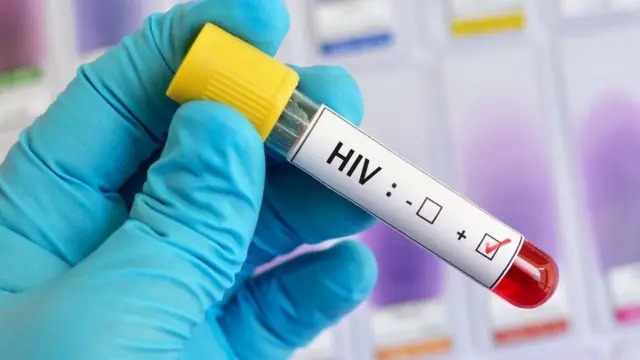 Kinshasa : une fillette de 10 ans contaminée par le VIH après une transfusion sanguine à Masina