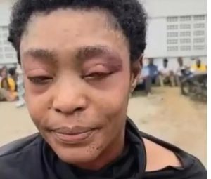 Lire la suite à propos de l’article RDC : le ministre des Droits humains dénonce les violences infligées à Honorine Porche lors de son arrestation