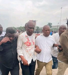 Lire la suite à propos de l’article Kinshasa : la tension monte autour du sit-in de la C64, deux opposants blessés signalés